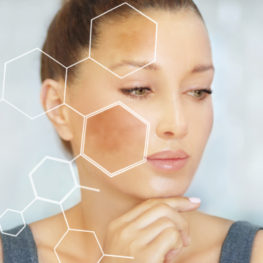 How to remove dark spots naturally with kojie san soap (complete guide)