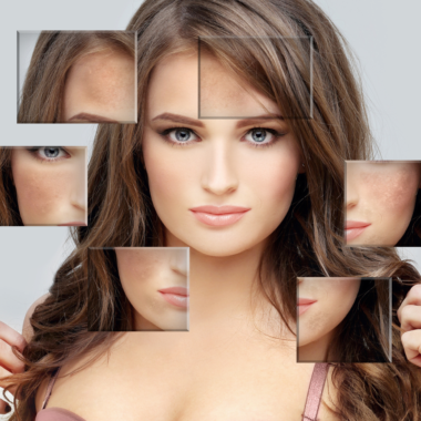 How to remove pigmentation fast using kojie san soap (complete guide)